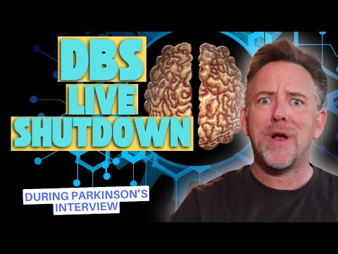 DBS for Parkinson's:
