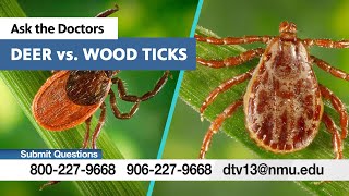 Deer Vs. Wood Ticks - Doctors Advice