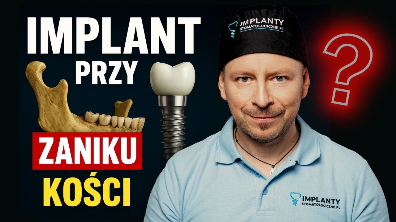 IMPLANTY ZYGOMATYCZNE, A ZANIK KOŚCI - 98% skuteczności w najtrudniejszych przypadkach.