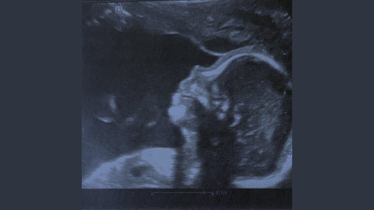 Watch Be (Alive) on YouTube Watch Be (Alive) on YouTube