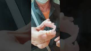 Thermoplasztikus És Flex A Fogsorok Királya