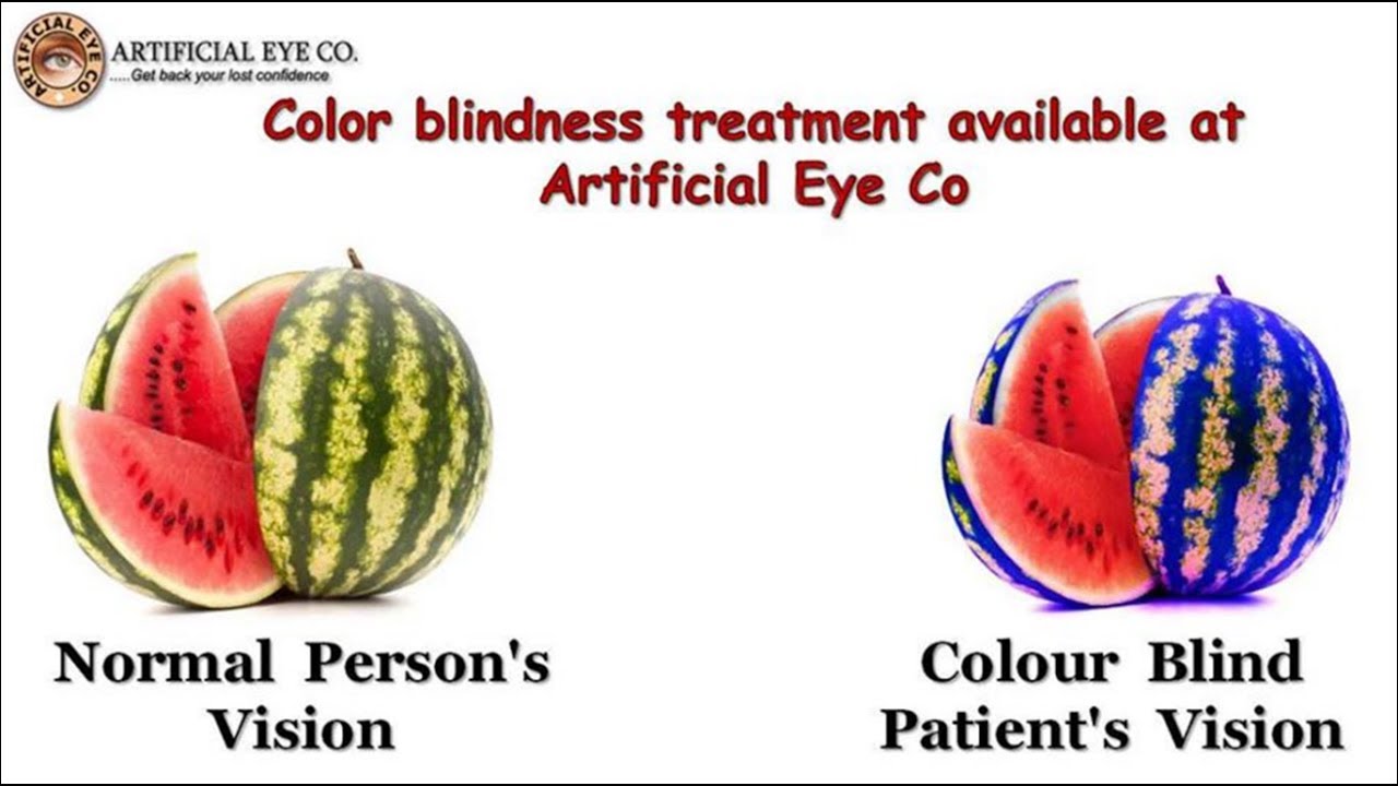 Color Blindness Pattern Of Inheritance Duplicitydesign