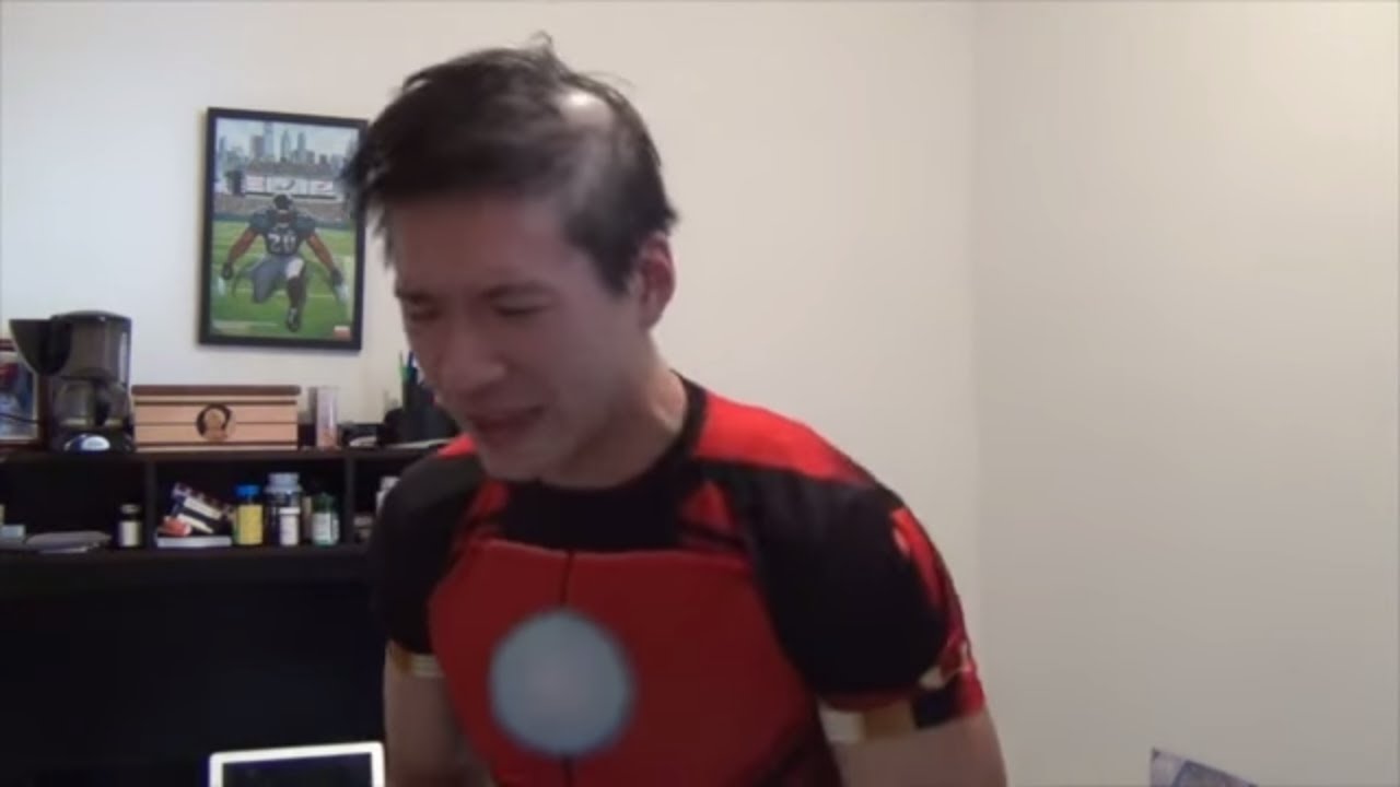 How I Overcame Alopecia Areata