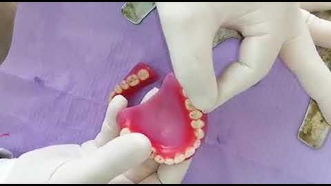 Visit 4: Occlusal marks reading s. Eccentric check, BULL rule