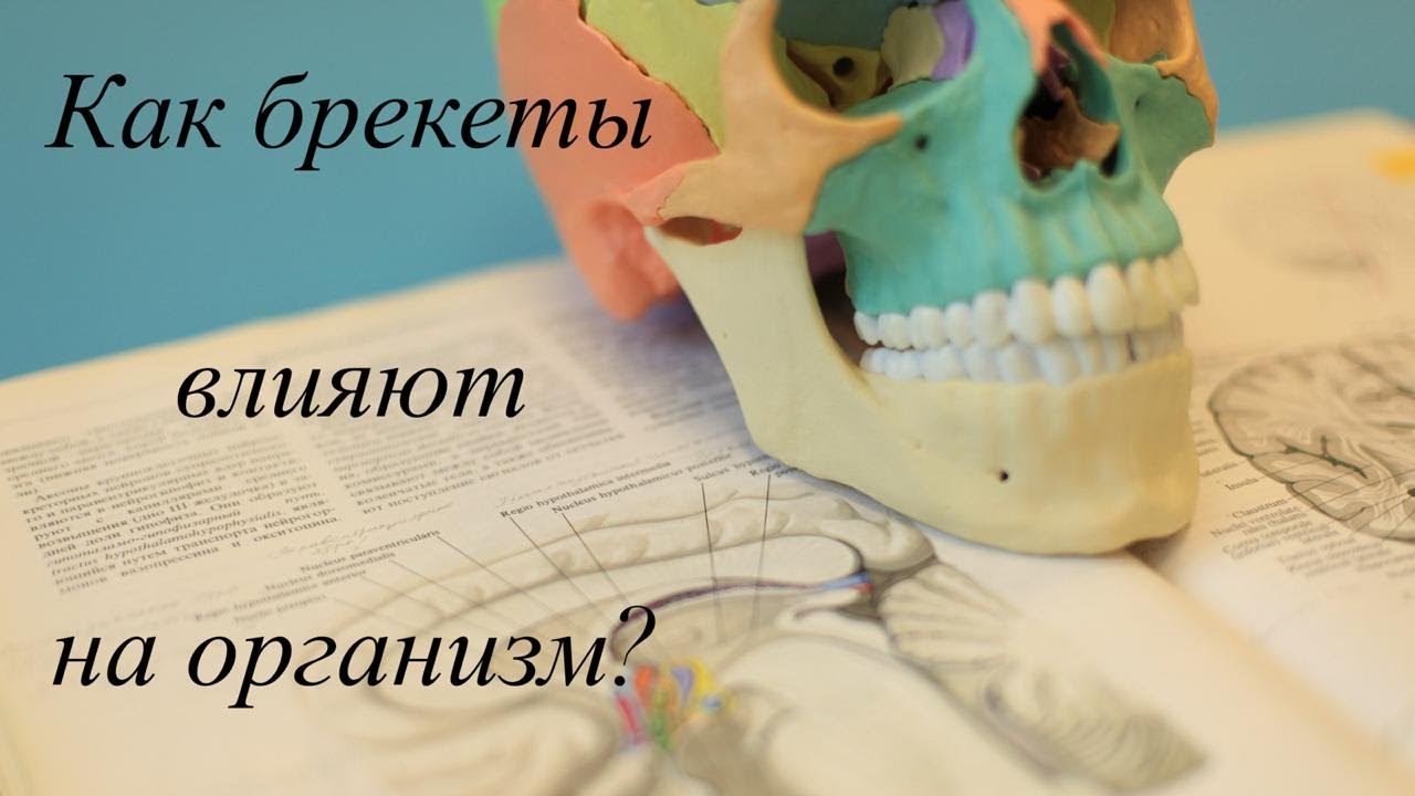 Как брекеты влияют на остальной организм?