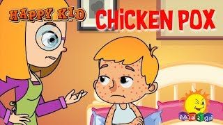 Happy Kid Chicken Pox Episode 41 Kochu Tv Malayalam