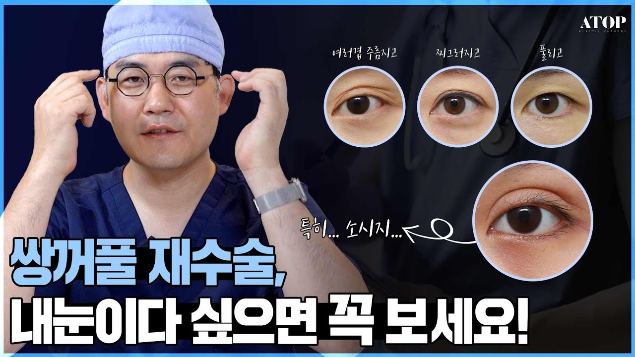 [Эйтоп Гоо Сайхны Мэс Заслын Эмнэлэг] [Доктор И Ханжон] Анхны нүдний мэс засал бүтэлгүйтсэн бол?💦 Заавал үзээрэй!💥 Тохиолдол бүрээр шалган үзэх нүдний давтан мэс засал🤞💗