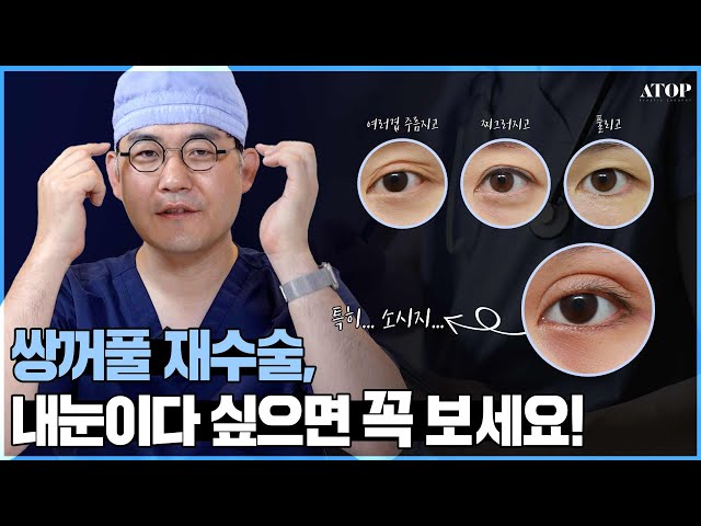 [Dr.이한정] 첫 눈수술이 망쳤다면?💦필수시청!💥 사례별로 확인하는 눈재수술🤞💗