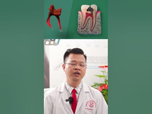Outline Video LẤY TỦY RĂNG CÓ ĐAU KHÔNG? | BS NGÔ TÙNG PHƯƠNG