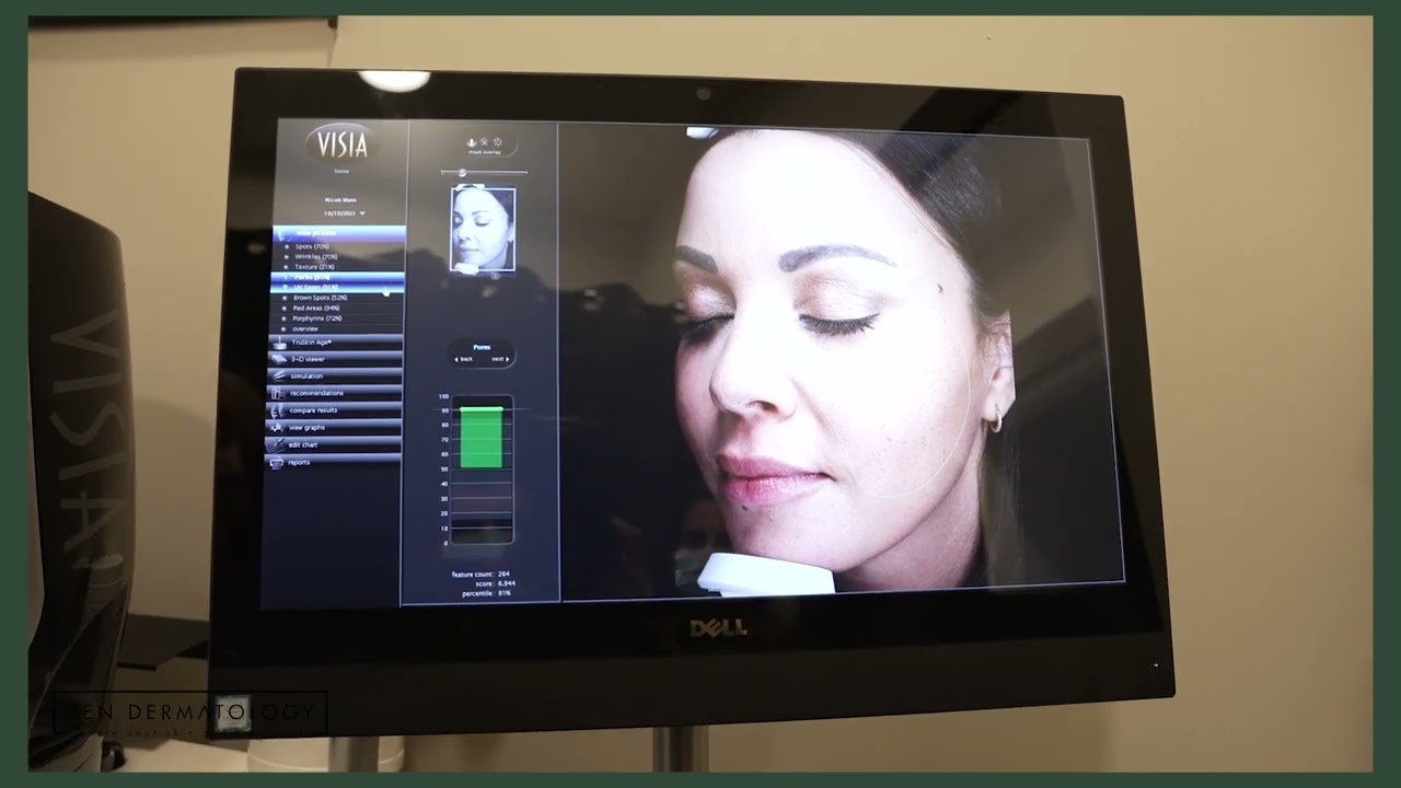 Zen ReGen VISIA Skin Analysis