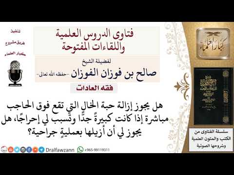 ما حكم إزالة العيوب الخلقية؟ لمعالي الشيخ صالح الفوزان