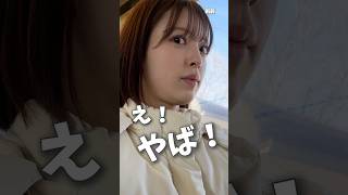 【脂肪吸引】二重アゴが嫌過ぎて脂肪吸引した結果　#ビフォーアフター #shorts #脂肪吸引｜脂肪吸引けいのすけチャンネル