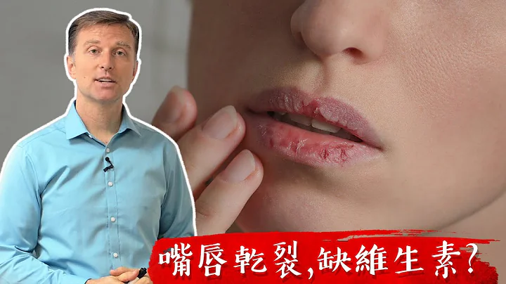 嘴唇乾裂,缺什麼維生素? 自然療法, 柏格醫生 Dr Berg - 天天要聞