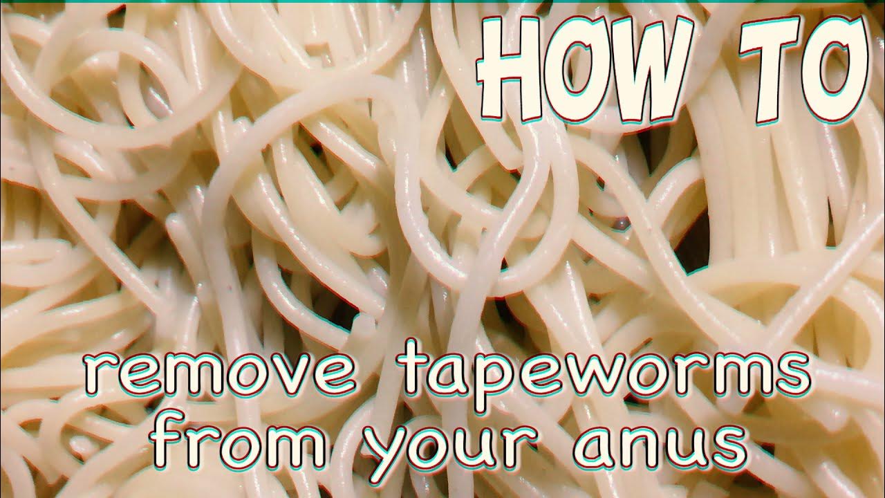How To Remove Tapeworms From Your Anus /Tutorial YouTube