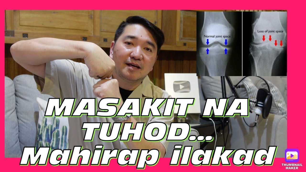 EFFECTIVE ba ang GLUCOSAMINE na SUPPLEMENT?