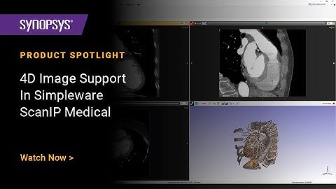 4D Image Support in Simpleware ScanIP Medical S-2021.06