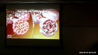 230924 Class 15 Act 1, Respiratory Emergencies