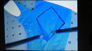 URMC Laparoscopic Olympics Task 4