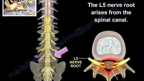 L5 Nerve Root - Everything You Need To Know - Dr. Nabil Ebraheim