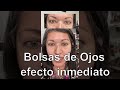Por Fin Adiós A Las Bolsas De Ojos Increíble Efecto Inmediato mp3
