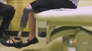 New Surgery Relieves Nerve Pain For Amputees