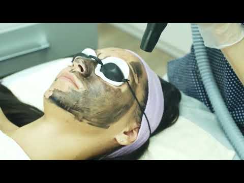 Vídeo del tratamiento de peeling de carbono en FBS Beauty