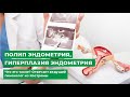 Полип эндометрия гиперплазия эндометрия. Что это такое? Отвечает ведущий гинеколог из Костромы