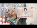 Kulit Kusam? Kulit Tidak Sekata? Y.O.U Radiance Up! Brightening Series - Cerah Dalam 14 Hari