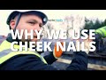 Why We Use Cheek Nails