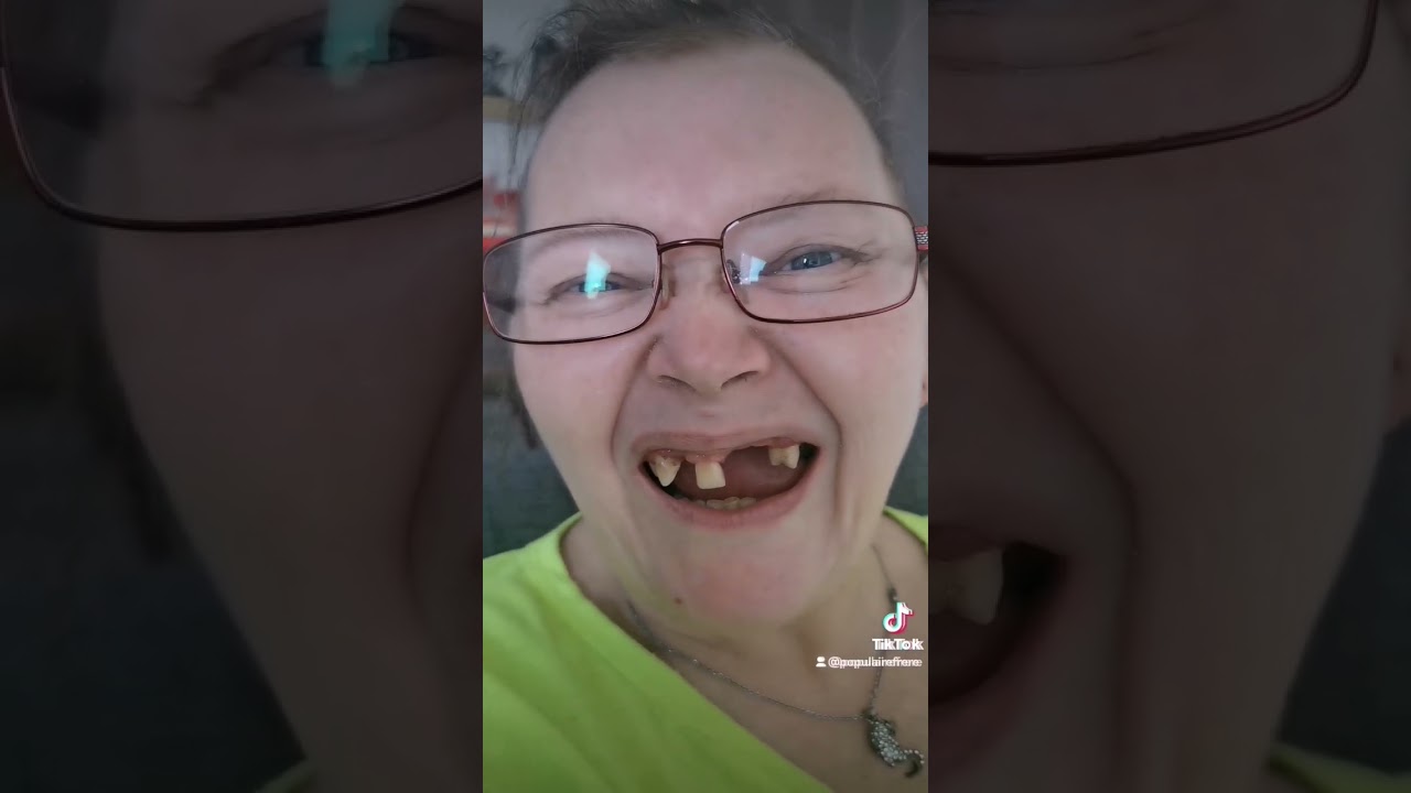 les dents de la mère 