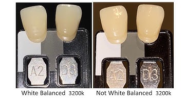 03 Dental Photography:  White Balance