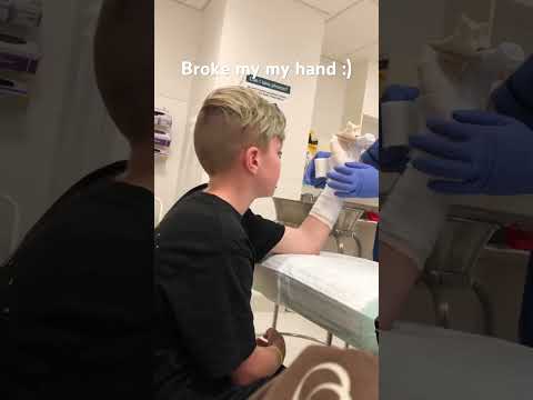 Broke my hand