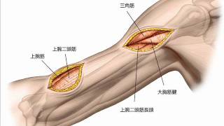 【南江堂】整形外科医のための手術解剖学図説　原書４版