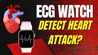 Can a ECG Watch Detect a Heart Attack