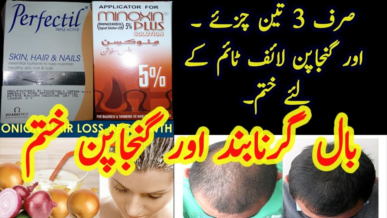 How To Regrow Hair Stop Hair Loss Tips Urdu Hindi Homemade