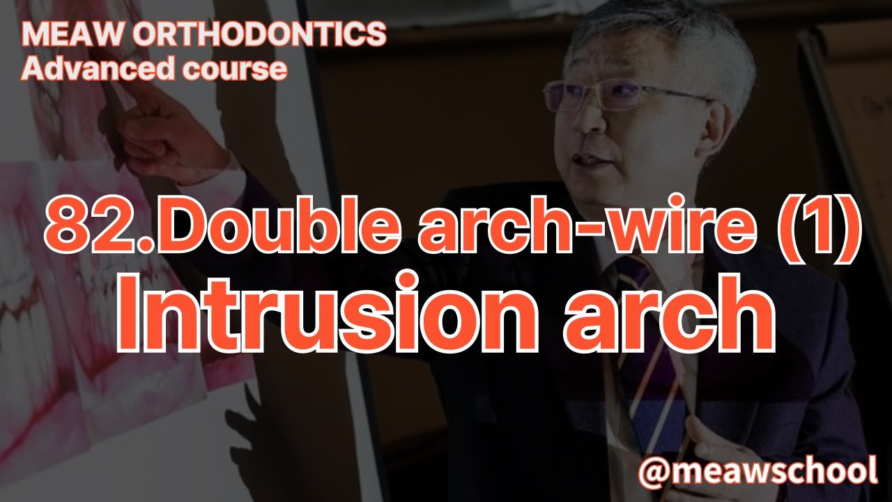 82.Double arch-wire (1)  Intrusion arch