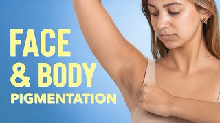 PIGMENTATION on your UNDERARMS, FACE, KNEES &amp; ELBOWS? | Top hyperpigmentation remedies you need!