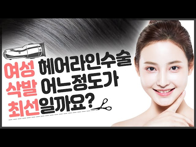 의느님답변📂ㅣ여성 헤어라인수술 삭발 어느정도가 최선일까요? [의느님답변 117회_다양한 삭발방법과 삭발의 중요성]