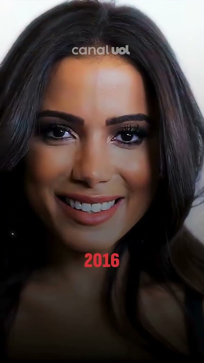 Anitta com novo rosto! Veja o antes e depois dos procedimentos e mudanças no visual da cantora