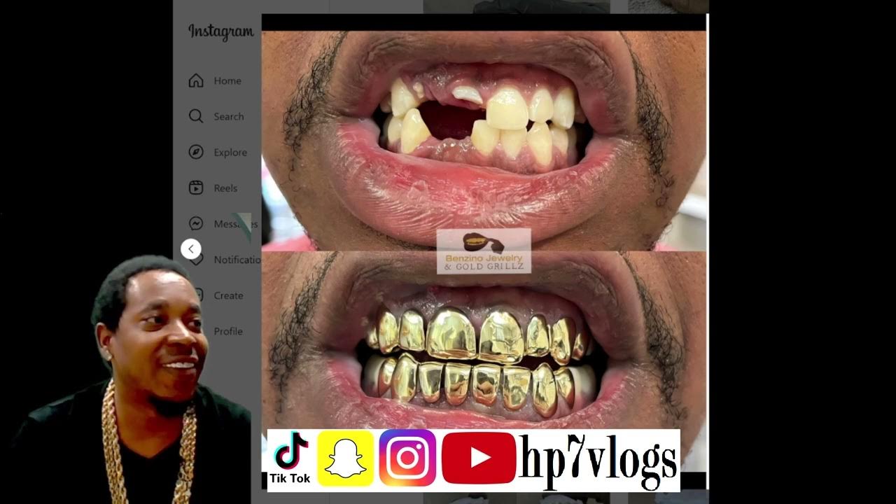 perm Cuts gold grillz over missing teeth YouTube