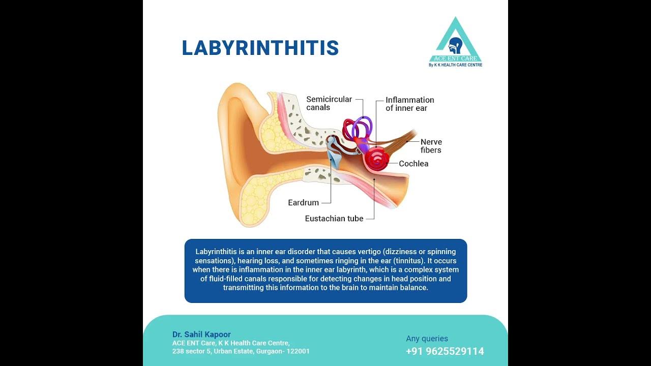 LABYRINTHITIS YouTube