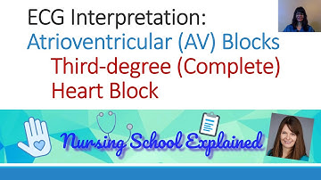 Third Degree/Complete AV (Heart) Block