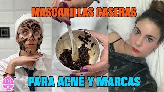 Homemade masks for acne-prone skin / treatment and results screenshot 2