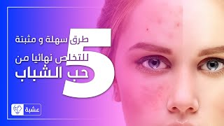 #حب_الشباب - القصة المرعبة في الوسط الشبابي  / أسباب الظهور و #العلاج_الطبيعي في ايام قليلة