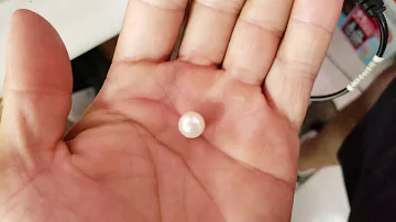 O que fazer quando a impressora está imprimindo torto?