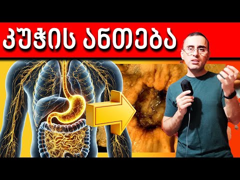 როგორ განვიკურნო გასტრიტისგან სამუდამოდ?  გასტრიტის ნიშნები მიზეზები და მკურნალობა
