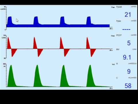 Ventilator Mode Classification: Primary Breath-Control Variables - YouTube