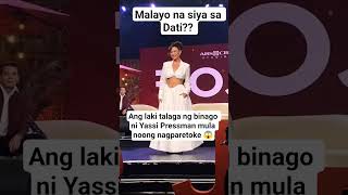 Malayo na sa dati ang mukha ni Yassi Pressman dahil sa retoke #trendingshorts #trending #trend