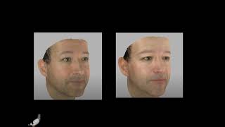 Geometry Processing – Parameterization2