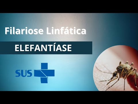 Filariose linfática - elefantíase (filaríase)